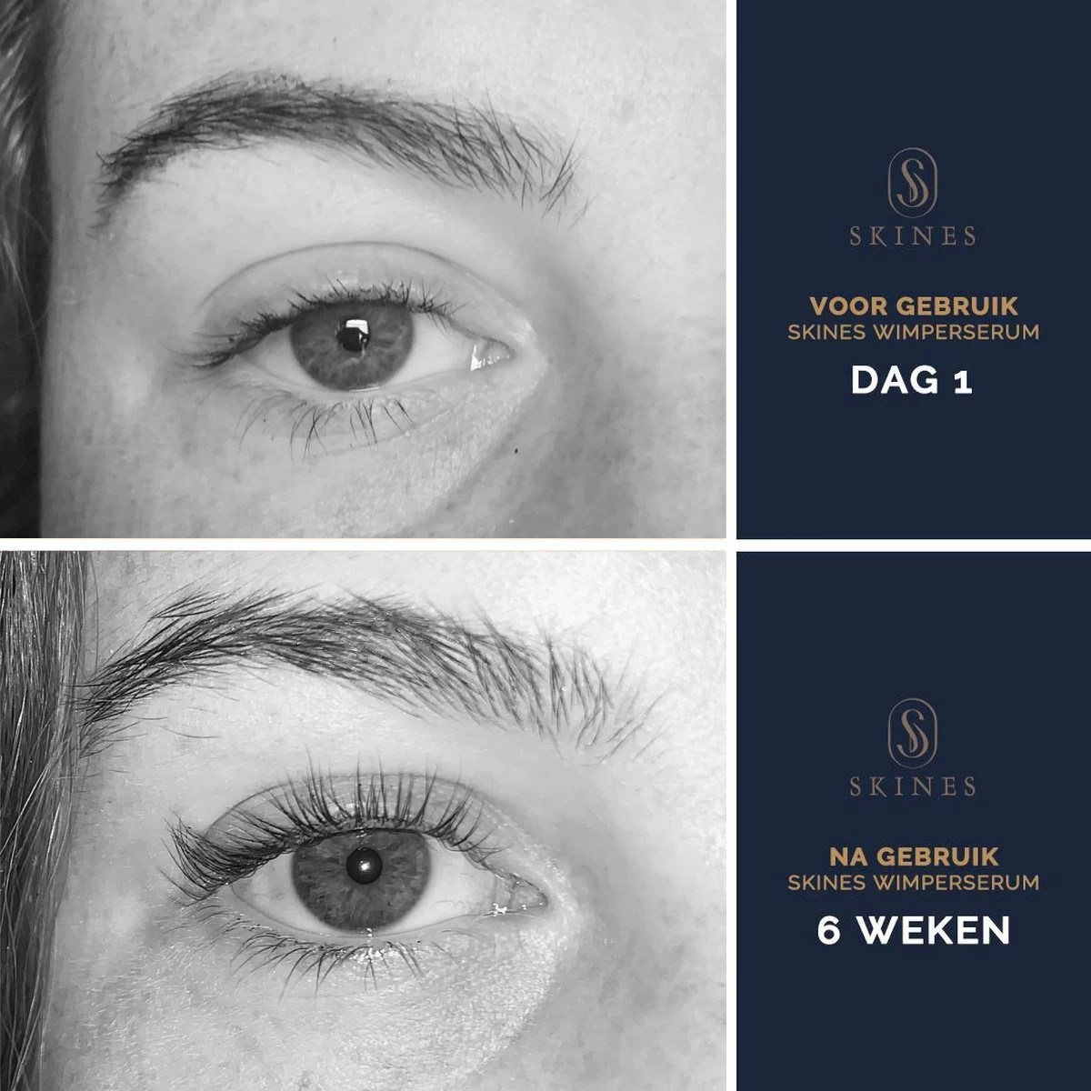 Skines® Wimperserum Premium – Eyelash Serum - Wenkbrauw Serum - Wimper Groei - 3ML - Afbeelding 6