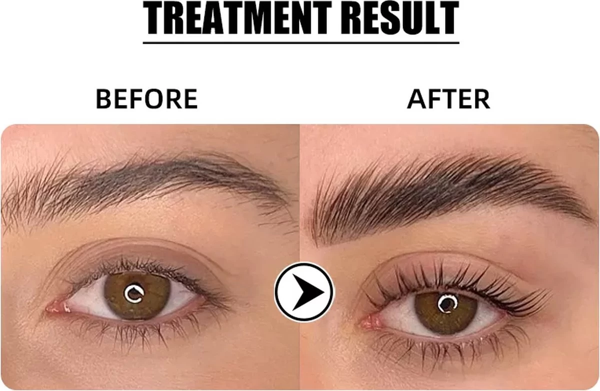 Flora Ruby - Wimper & Wenkbrauw Lifting Set 2 In 1 - Professionele 2 In 1 Lash Lift & Brow Lamination Kit - Permanente Wimperkruller - Afbeelding 4